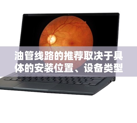 油管线路的推荐取决于具体的安装位置、设备类型、油品种类以及安装要求。以下是一些常见油管的推荐类型和位置，供您参考